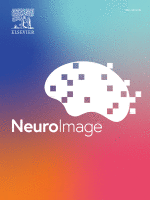 NeuroImage cover